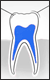 Teeth Whitening Diagram